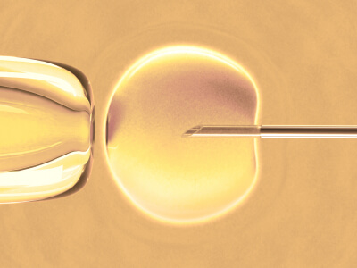 Применение донорской спермы